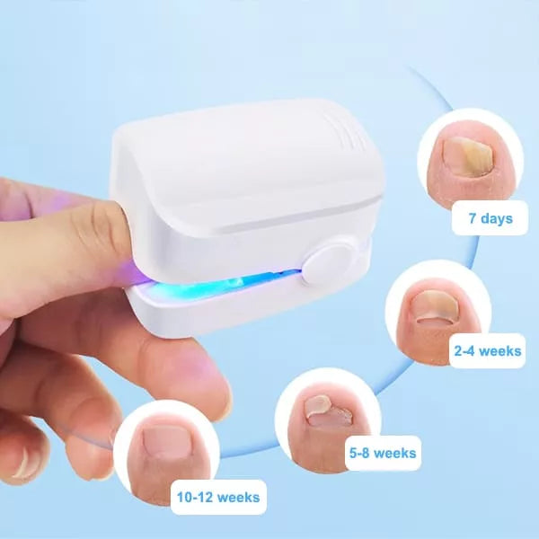 Skanto | Nail Fungus Cleaning Laser Device