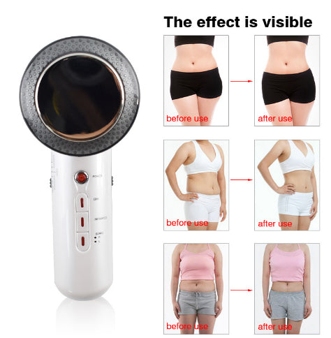 Skanto | Ultrasound Massager Device
