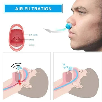 Skanto | Mikro CPAP Sleep Apnea Machine for Travel and Anti-Snoring – CPAP Alternative