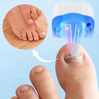 Skanto | Nail Fungus Cleaning Laser Device