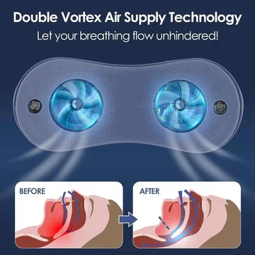 Skanto | Mikro CPAP Sleep Apnea Machine for Travel and Anti-Snoring – CPAP Alternative