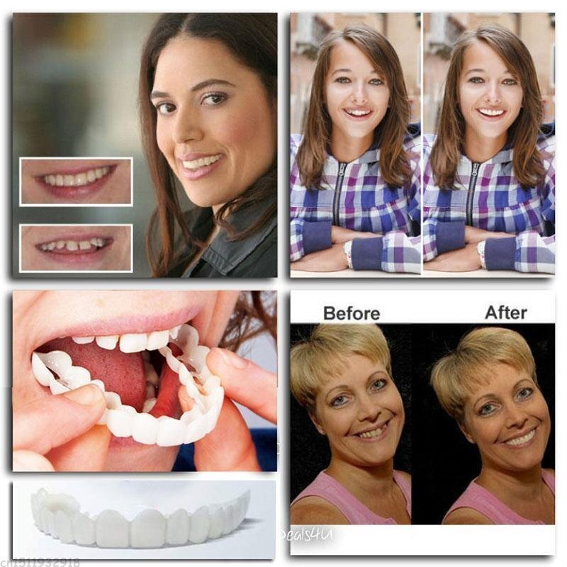 Skanto | Snap-On Dentures