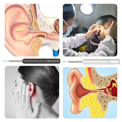 Brehn | Smart visible ear picker