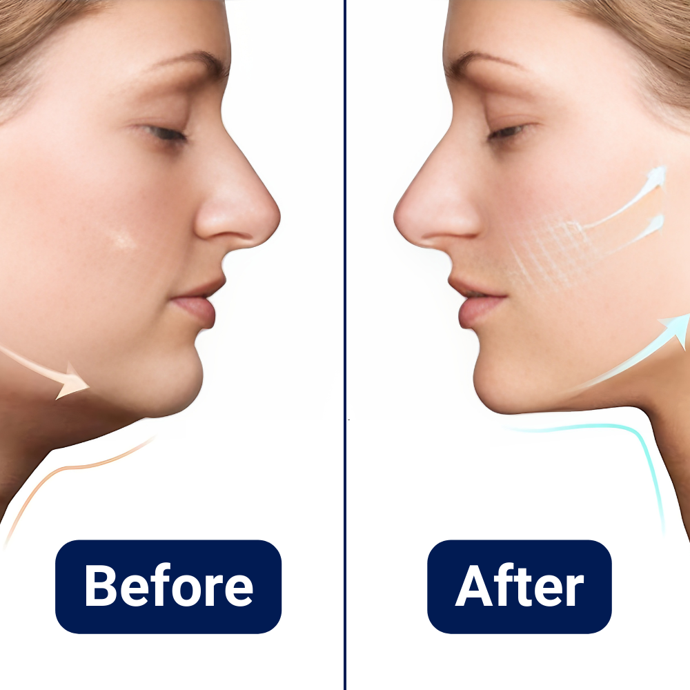 Face Lifting Massager for Double Chin Reduction Skanto