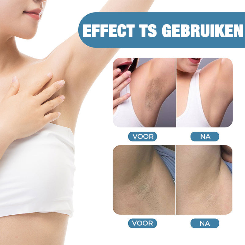 Skanto | Skanto Shine Effective Underarm Lightener for Women