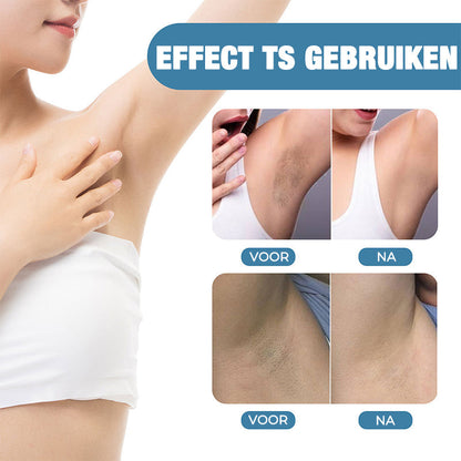 Skanto | Skanto Shine Effective Underarm Lightener for Women
