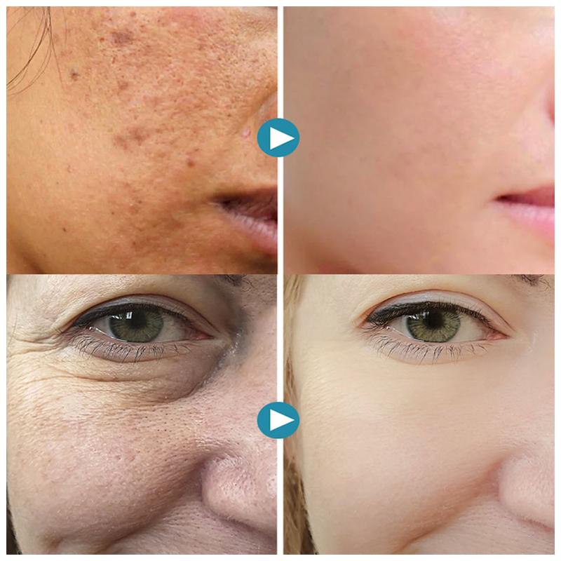 SilkPores Smooth and radiant skin | Brehn
