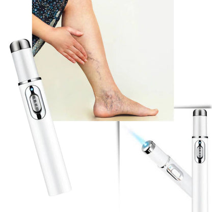 ClearGlow Blue Light Skin Therapy Pen | Acne Treatment - Anti-inflammatory - Non-invasive Solution - Clearer Skin - Spot Reduction Skanto