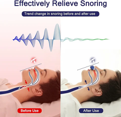 Micro-CPAP sleep apnea device for travel and anti-snoring