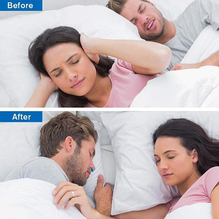 Micro CPAP Anti-Snoring Electronic Device