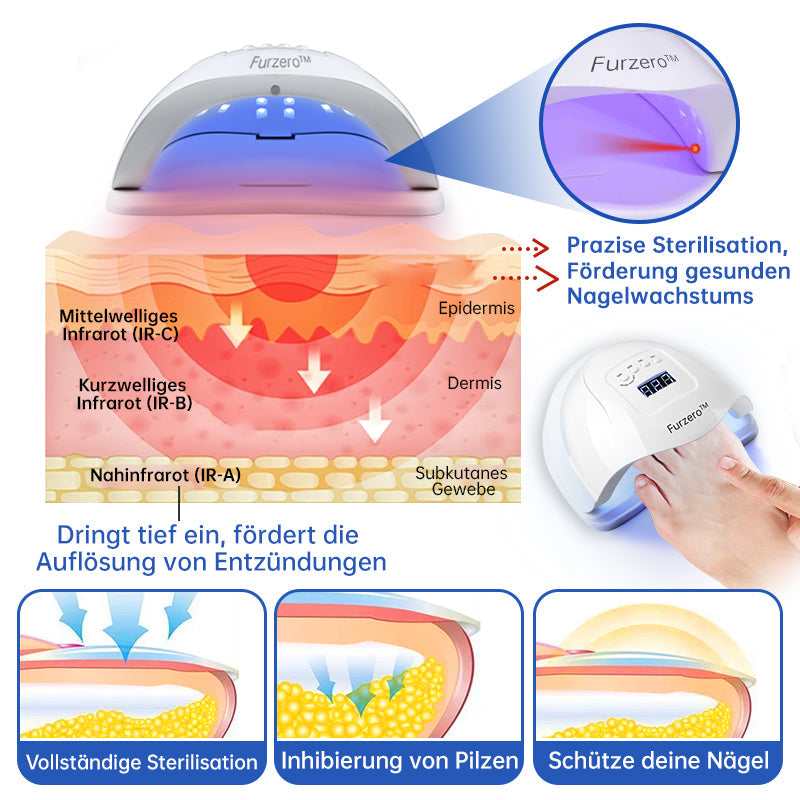 Skanto | PureNail™ | Nail Fungus Laser Treatment Device - Your Secret Weapon Against Nail Fungus