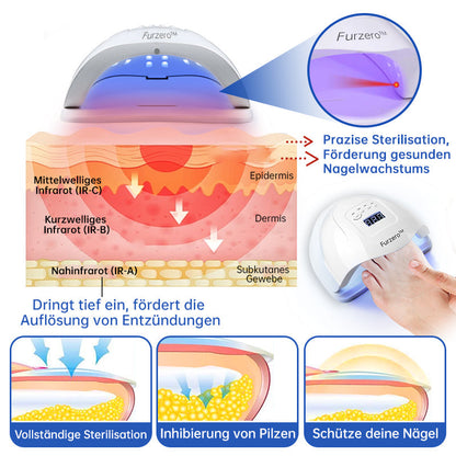 Skanto | PureNail™ | Nail Fungus Laser Treatment Device - Your Secret Weapon Against Nail Fungus
