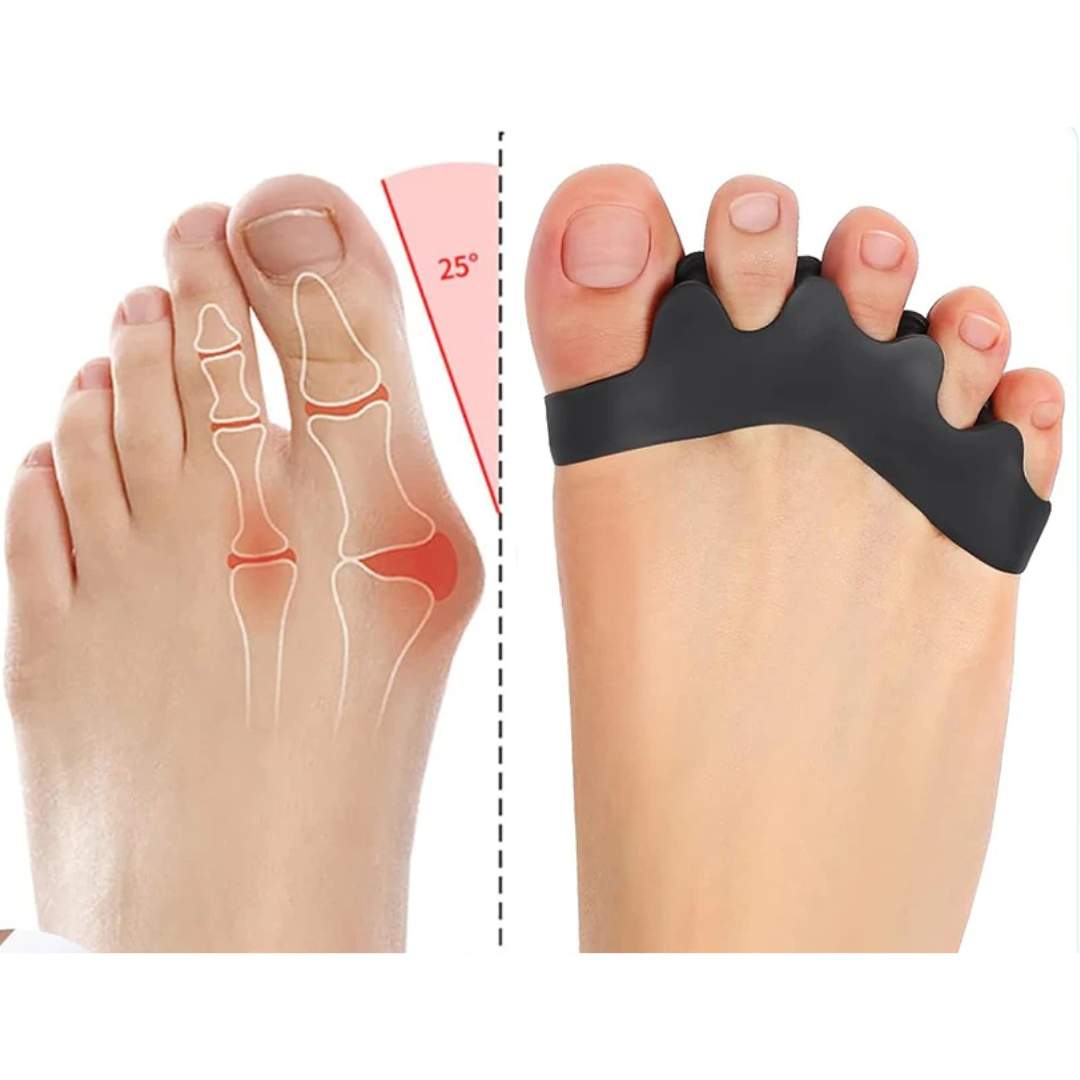 FlexAlign Toe Spacer | Toe Realignment and Pain Relief – Ideal for Bunions - Overlapping Toes - and Foot Comfort Bowlift