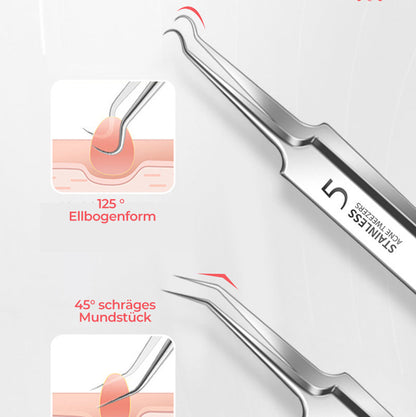 BowLift | Tweezer for Removing Blackheads on the Face