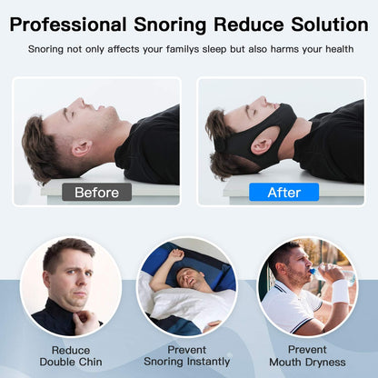 Anti-Snoring Chin Strap for Sleep Apnea