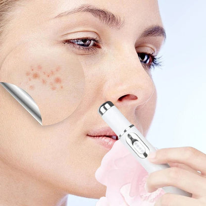 BowLift | ClearDerm - Quick, painless pimple removal for smooth, clear skin