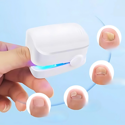 Skanto | Laser Nail Treatment Device for Fungus