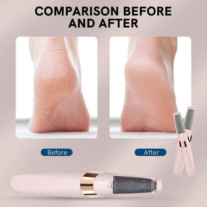 Skanto Electric Foot File Hard Skin Remover Skanto
