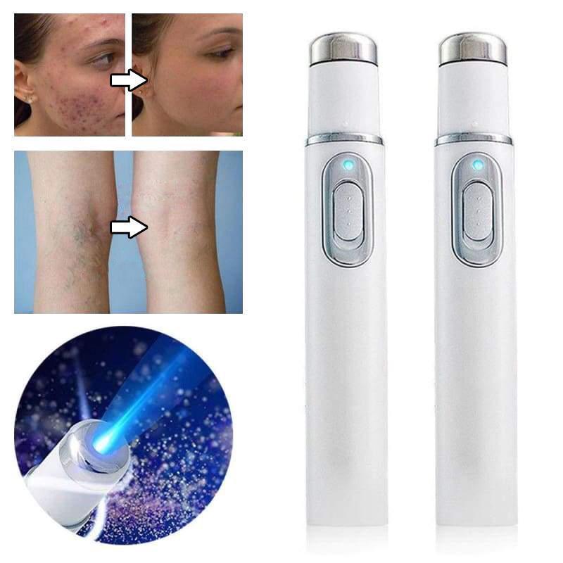 Laser treatment pen Blu-Ray remove unwanted acne
