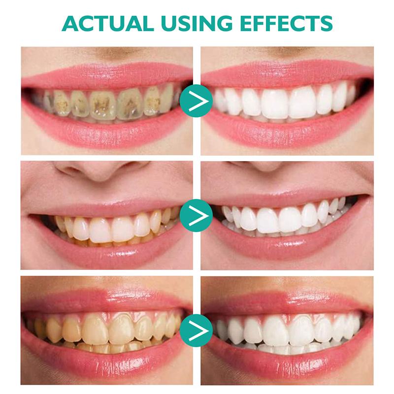 Skanto | Whitening Foam Toothpaste