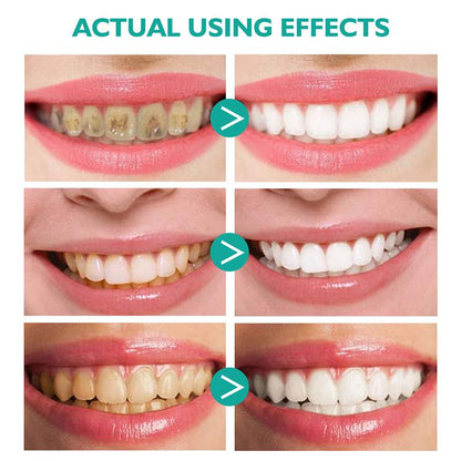 Skanto | Whitening Foam Toothpaste