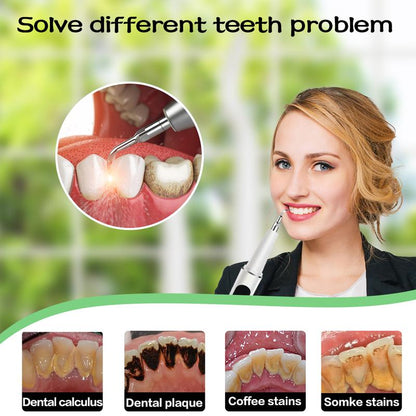 Ultrasonic Electric Tooth Cleaner Karnz
