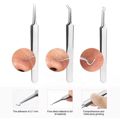 BowLift | Tweezer for Removing Blackheads on the Face