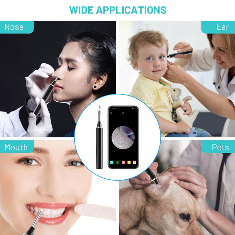 Skanto | Wireless Ear Wax Removal Tool