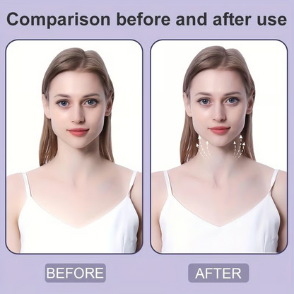 BowLift | VelvetLift — Shine instantly youthful and confident with invisible power lift