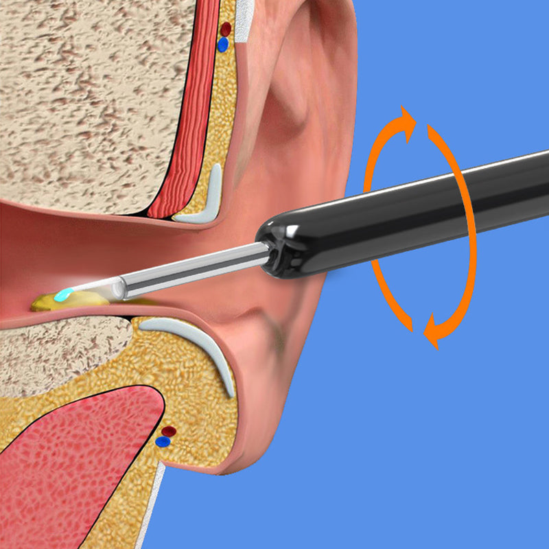 Brehn | Smart visible ear picker