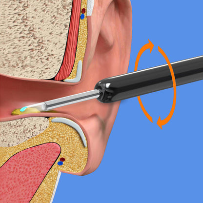 Brehn | Smart visible ear picker