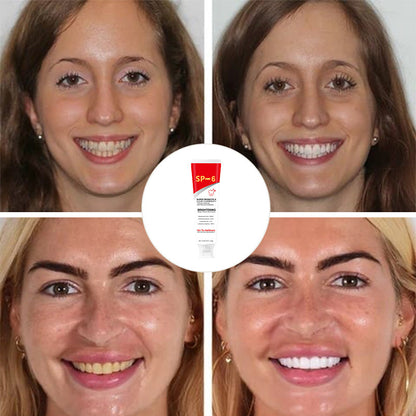 BowLift | Super Probiotic-6 Toothpaste