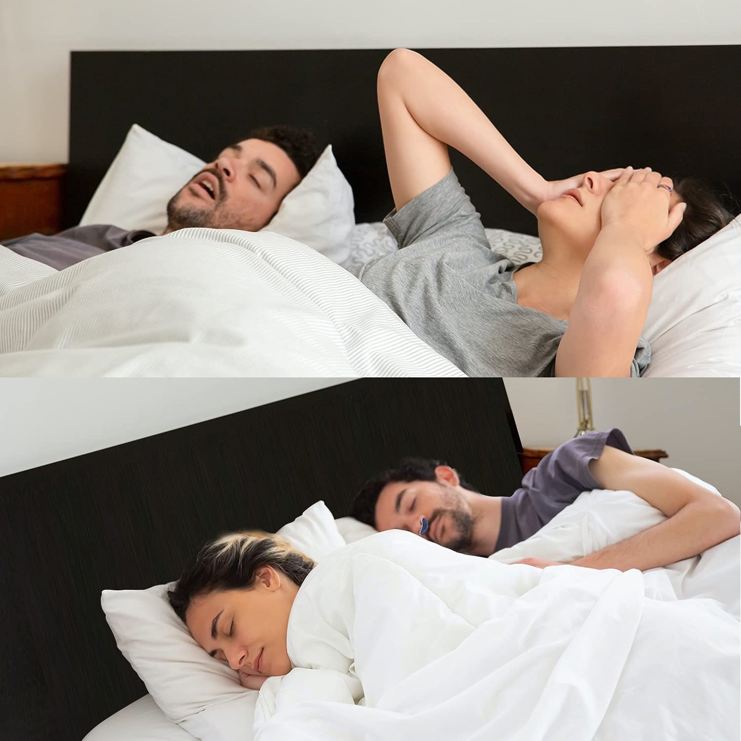 Anti-Snoring Device | Hose-, Mask- Free Micro-CPAP
