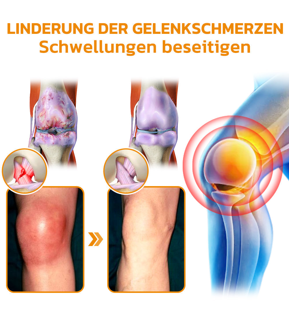 Bee Venom Joint Cream | Bowlift