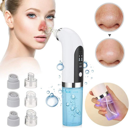 Skanto | Professional Blackhead Remover Vacuum - Deep Cleansing with Suction Technology