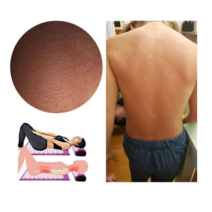 Skanto | Acupressure Yoga Mat & Pillow Set for Natural Pain Relief & Relaxation