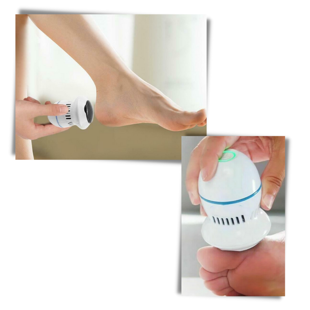 Electric Hard Skin Remover