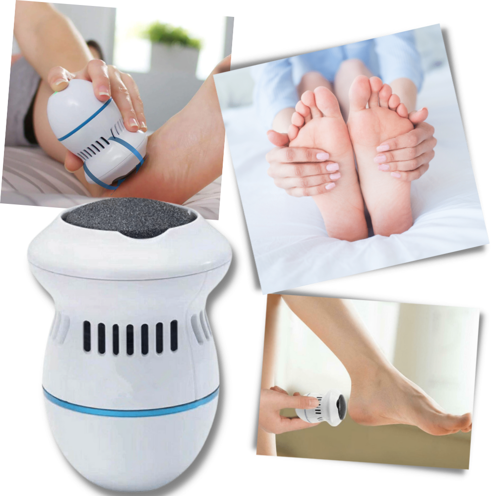 Electric Hard Skin Remover
