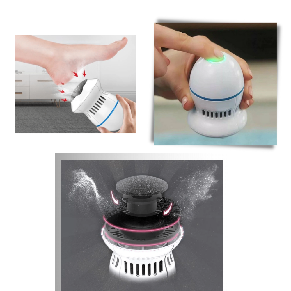 Electric Hard Skin Remover