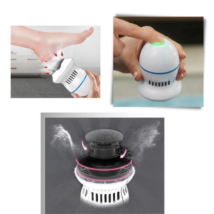Electric Hard Skin Remover