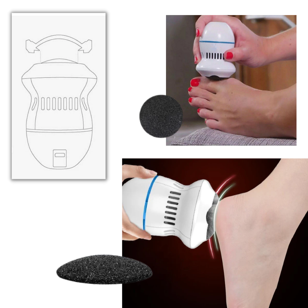 Electric Hard Skin Remover