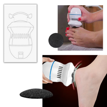 Electric Hard Skin Remover