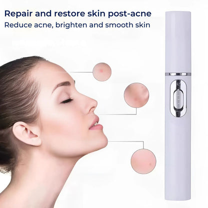 ClearGlow Blue Light Skin Therapy Pen | Acne Treatment - Anti-inflammatory - Non-invasive Solution - Clearer Skin - Spot Reduction Skanto