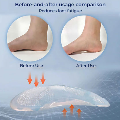 ComfortStep Gel Arch Support Insoles | Relieve Foot Pain - Reduce Fatigue - Improve Posture - Shock Absorbing Insoles Kalsten