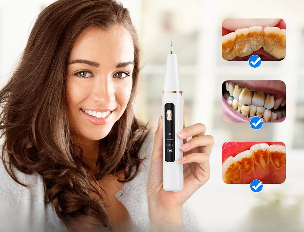 Skanto | Ultrasonic Teeth Cleaner | 38 kHz Ultrasound, LED Light & USB Fast Charging for Home Dental Care