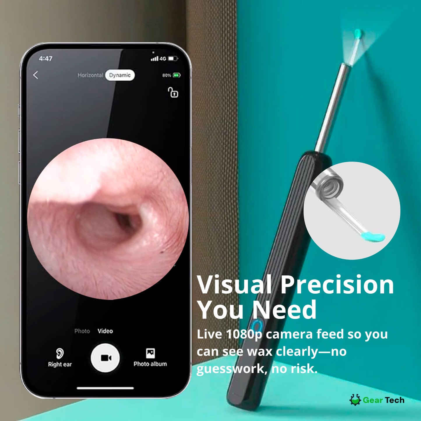 Skanto | EarScope Pro Earwax Removal Kit | High-Definition Camera & LED Light for Safe Home Use