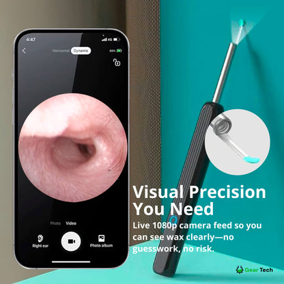 Skanto | EarScope Pro Earwax Removal Kit | High-Definition Camera & LED Light for Safe Home Use