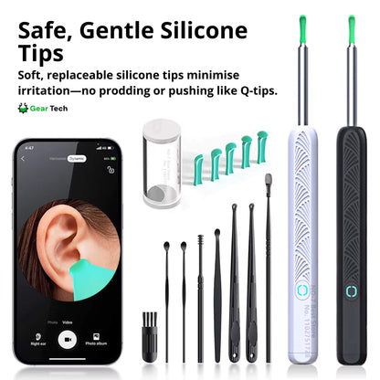 Skanto | EarScope Pro Earwax Removal Kit | High-Definition Camera & LED Light for Safe Home Use