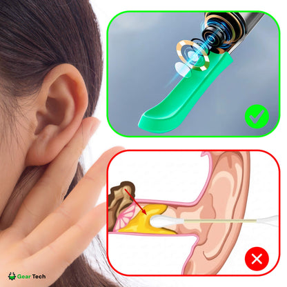 Skanto | EarScope Pro Earwax Removal Kit | High-Definition Camera & LED Light for Safe Home Use