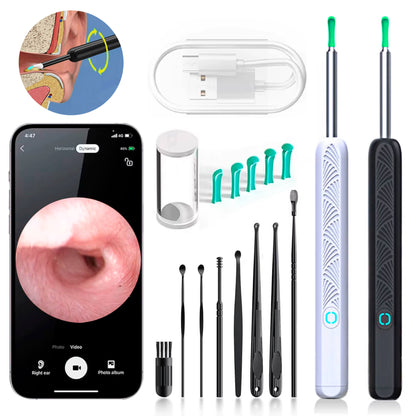 Skanto | EarScope Pro Earwax Removal Kit | High-Definition Camera & LED Light for Safe Home Use